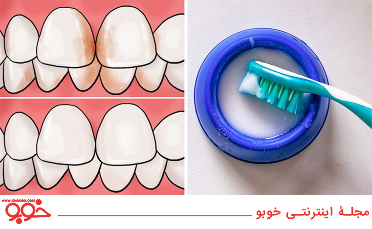 روش خانگی برای از بین بردن تارتار دندان