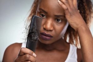 آیا کمبود ویتامین بر ریزش مو تأثیر دارد؟